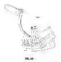 Fig. 02 - PERCUTANEOUS ROD INSERTER