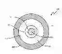 Fig. 01 - Pacing leads with a structured coating
