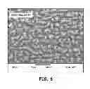 Fig. 08 - Pacing leads with a structured coating
