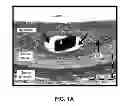 Fig. 02 - STENTS HAVING CONTROLLED ELUTION