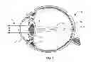 Fig. 02 - Lens providing extended depth of focus and method relating to same