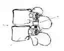 Fig. 01 - Distraction/compression posterior rod system