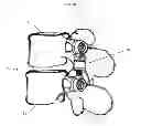 Fig. 09 - Distraction/compression posterior rod system