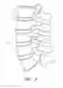 Fig. 02 - METHOD AND APPARATUS FOR MINIMALLY INVASIVE INSERTION OF INTERVERTEBRAL IMPLANTS