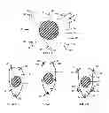 Fig. 07 - Resilient knee implant and methods