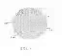 Fig. 04 - Porous ureteral stent