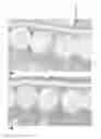 Fig. 42 - 3-dimensional large capacity cell encapsulation device assembly