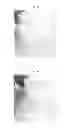 Fig. 05 - Connective-tissue-based or dermal-tissue-based grafts/implants