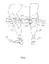 Fig. 09 - Joint control systems and methods utilizing muscle activation sensing