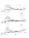 Fig. 05 - Smooth rollover insole for prosthetic foot