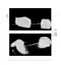 Fig. 07 - Smooth rollover insole for prosthetic foot