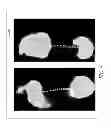Fig. 09 - Smooth rollover insole for prosthetic foot