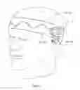 Fig. 07 - Swim cap and method of use thereof