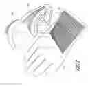 Fig. 04 - Lacrosse glove