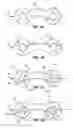 Fig. 04 - Pinny clip