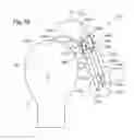 Fig. 17 - Head care apparatus