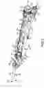 Fig. 04 - Mechanically-driven, sonic toothbrush and water flosser