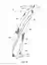 Fig. 07 - Twisted tubular web element and mop head made therefrom