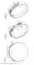 Fig. 02 - Hose clamp