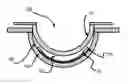 Fig. 01 - Method of forming a patterned multi-piece insert for an ophthalmic lens