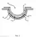 Fig. 02 - Method of forming a patterned multi-piece insert for an ophthalmic lens