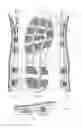 Fig. 02 - Sole structure for a running shoe