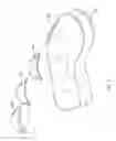 Fig. 02 - DEVICE AND METHOD FOR VARYING INSOLE CAMBER