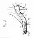 Fig. 03 - Removable shoe insert for corrective sizing