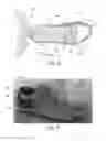 Fig. 06 - FOOTWEAR ARTICLE HAVING A TEMPERATURE REGULATION SYSTEM