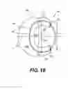 Fig. 10 - Retainer systems for ground engaging tools