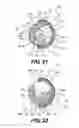 Fig. 12 - Retainer systems for ground engaging tools