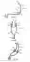Fig. 06 - Firearm trigger reset assist apparatus and method