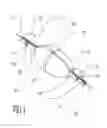Fig. 02 - Fishing device inserts