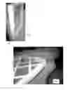 Fig. 02 - Paint booth filter