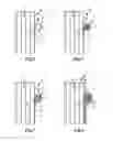 Fig. 04 - Filter element and method for production thereof