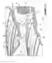 Fig. 04 - Combustor for gas turbine engine