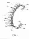 Fig. 02 - Anklet