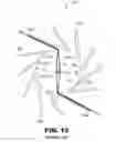 Fig. 07 - Stent crimping tool insert, system, and method