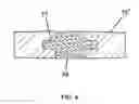 Fig. 05 - Biocompatible Filter