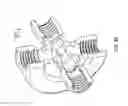 Fig. 35 - Connector with structural reinforcement and biocompatible fluid passageway