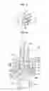 Fig. 06 - Pressure sensor