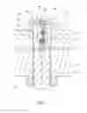 Fig. 07 - Threaded member capable of detecting tension