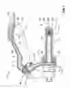 Fig. 03 - LEVER GUARD AND HANDLEBAR EXTENDER FOR MOTORCYCLE HANDLEBAR AND METHOD OF INSTALLING THE SAME