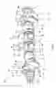Fig. 02 - SELECTIVELY STRENGTHENED CRANKSHAFT
