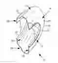 Fig. 01 - Ring Gear Shroud