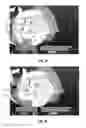 Fig. 06 - Dust collection system for a circular saw