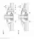 Fig. 08 - Supporting structure for electronic pad of percussion instrument