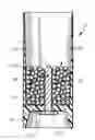 Fig. 01 - Shotgun shell tracer and tracer manufacturing device