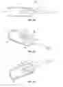Fig. 10 - Remote treatment system