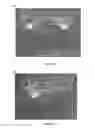 Fig. 07 - Surgical support device